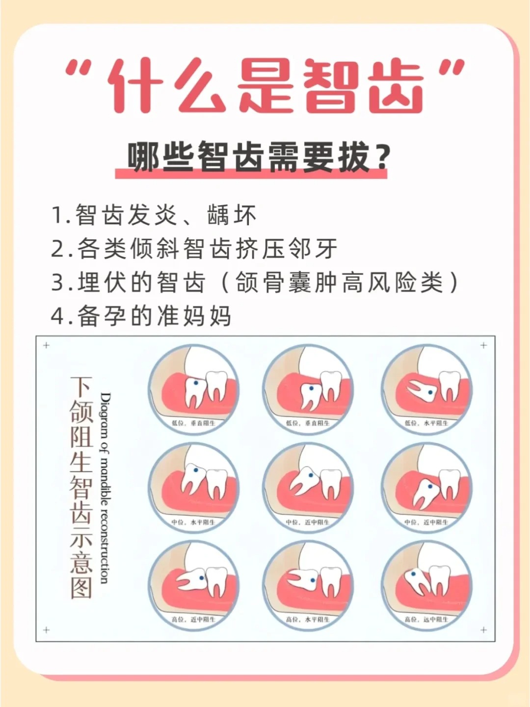 为什么有智齿