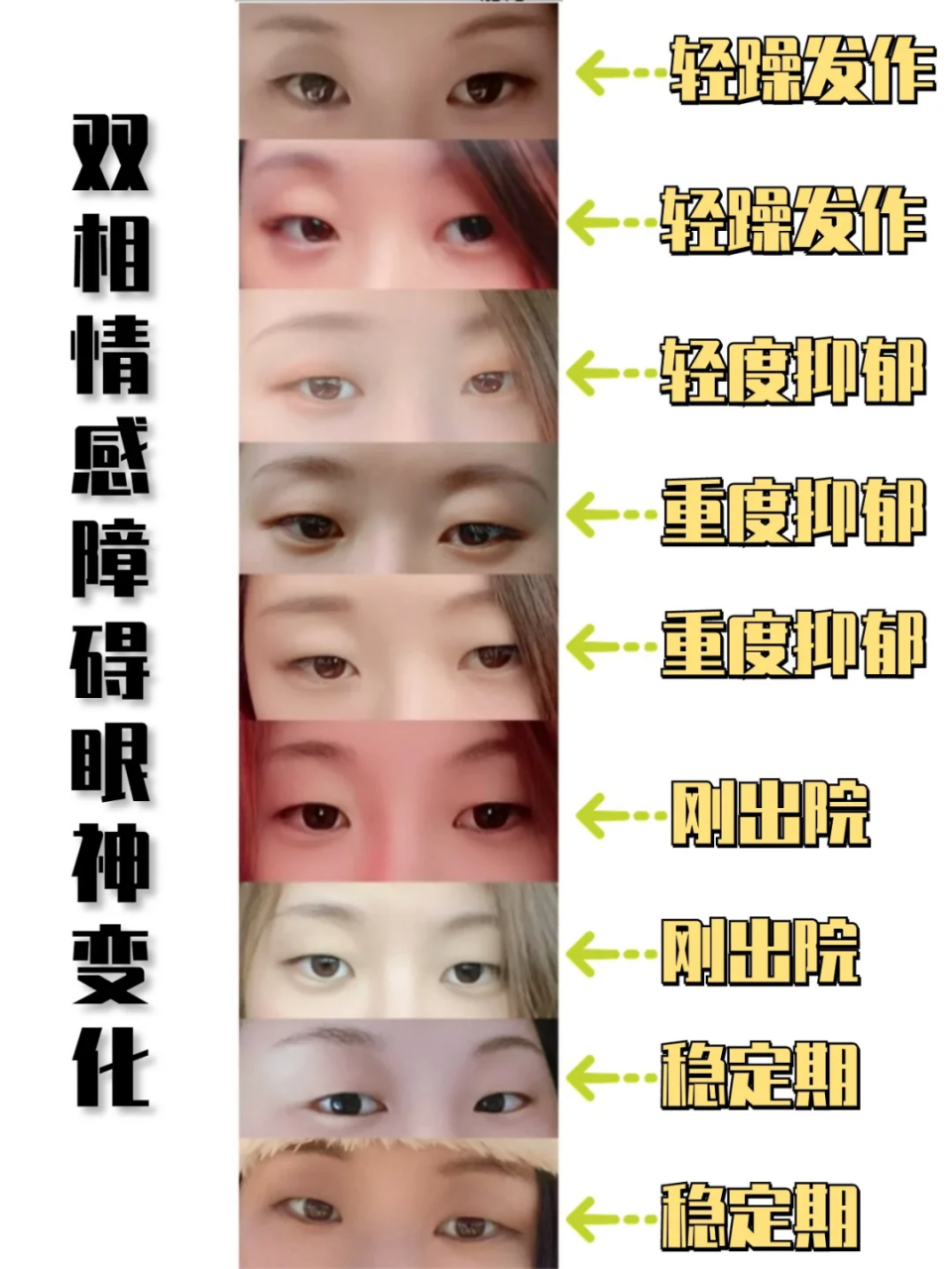 的眼神在这个阶段,眼神就像夜空中最亮的星星,闪烁着无限的光芒和活力