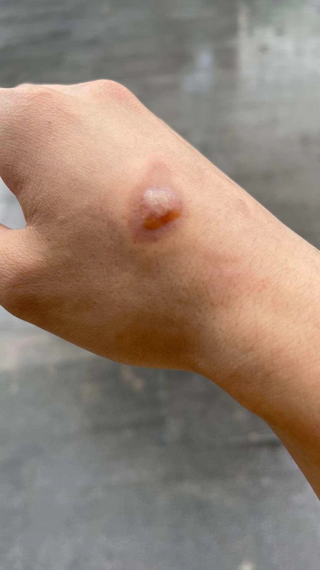 梦见蜂蜜咬自己(梦见蜜蜂咬了一口)