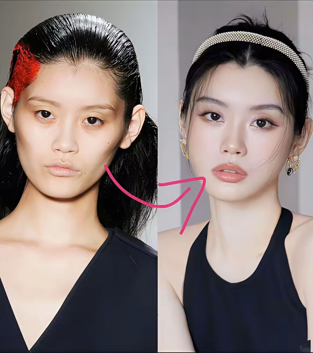 嫁入豪门之前高颧骨反耳蒜头鼻凸嘴颧骨外扩