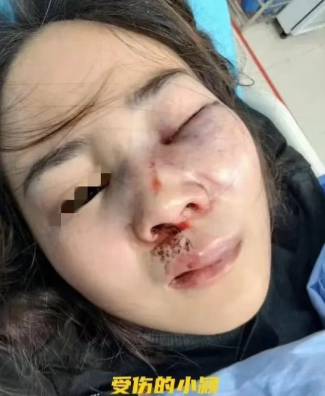 四川仁寿,怀孕女子刘晓颖好心劝男友少饮酒,却遭其狠