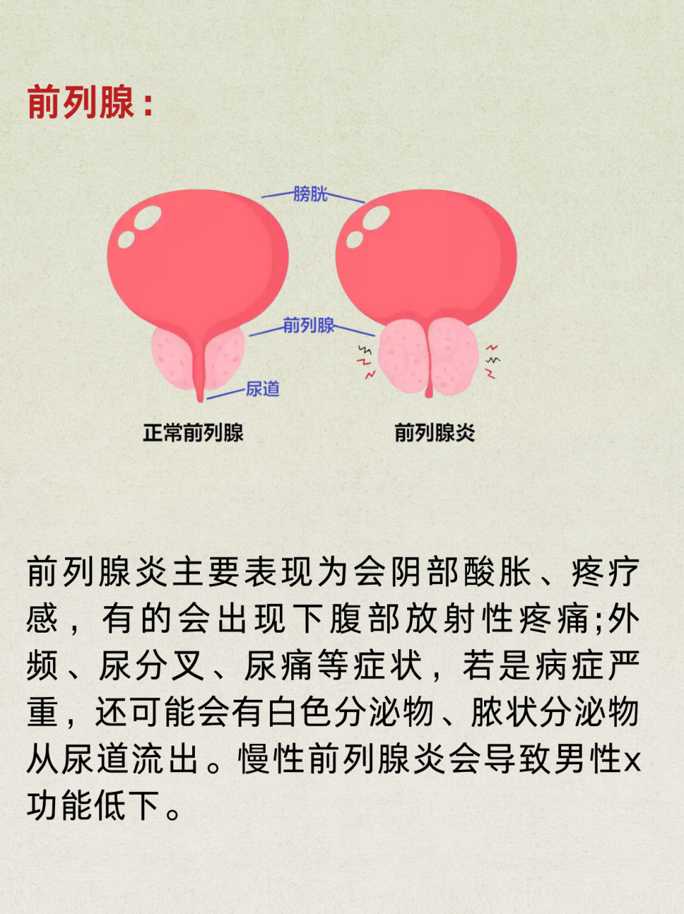 前列腺炎,可用一味中药煮水喝!#男科# #健康科普# #中医男科