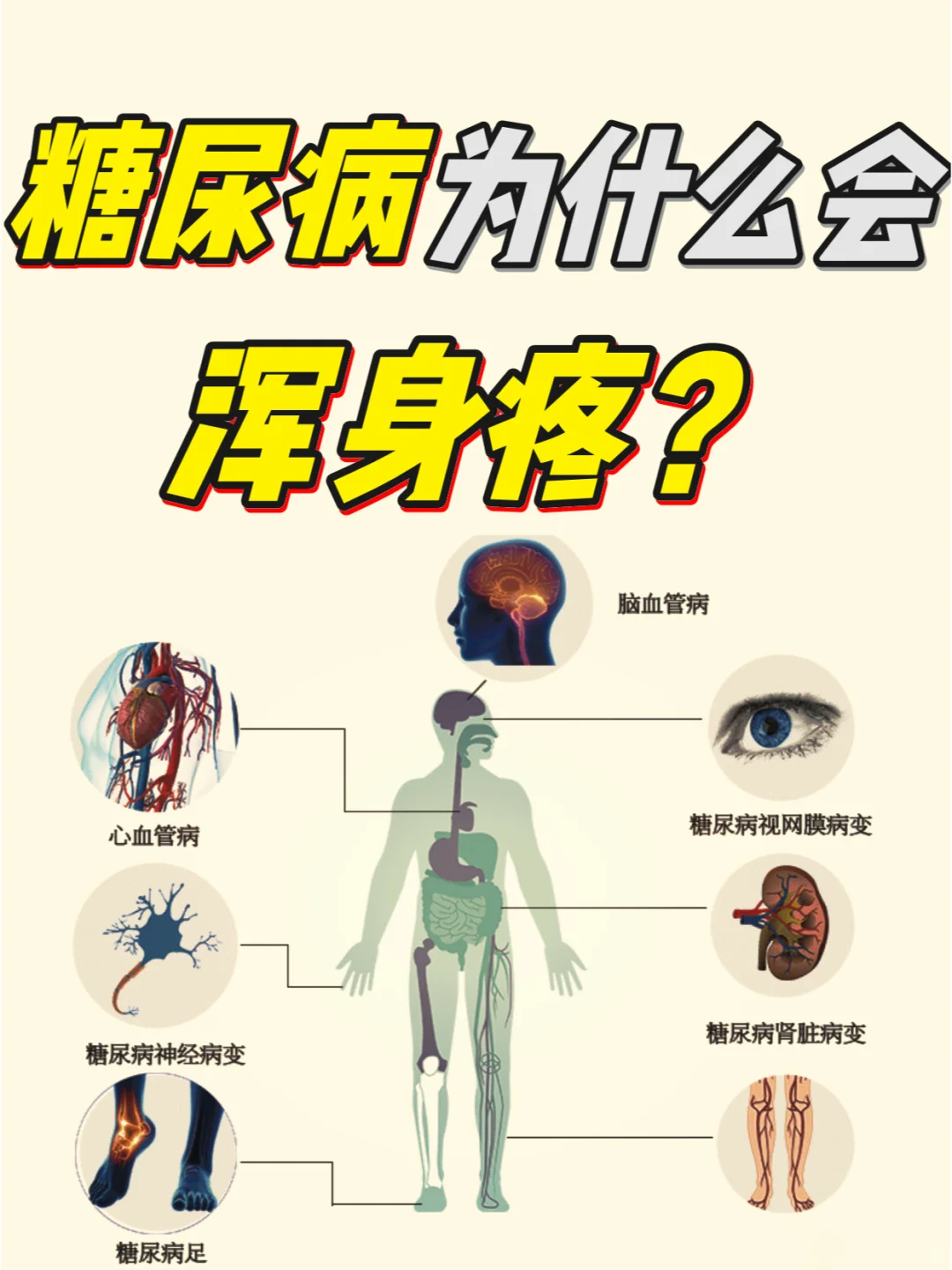 糖尿病不只是血糖高那么简单,它还可能让你全身痛到怀疑人生!