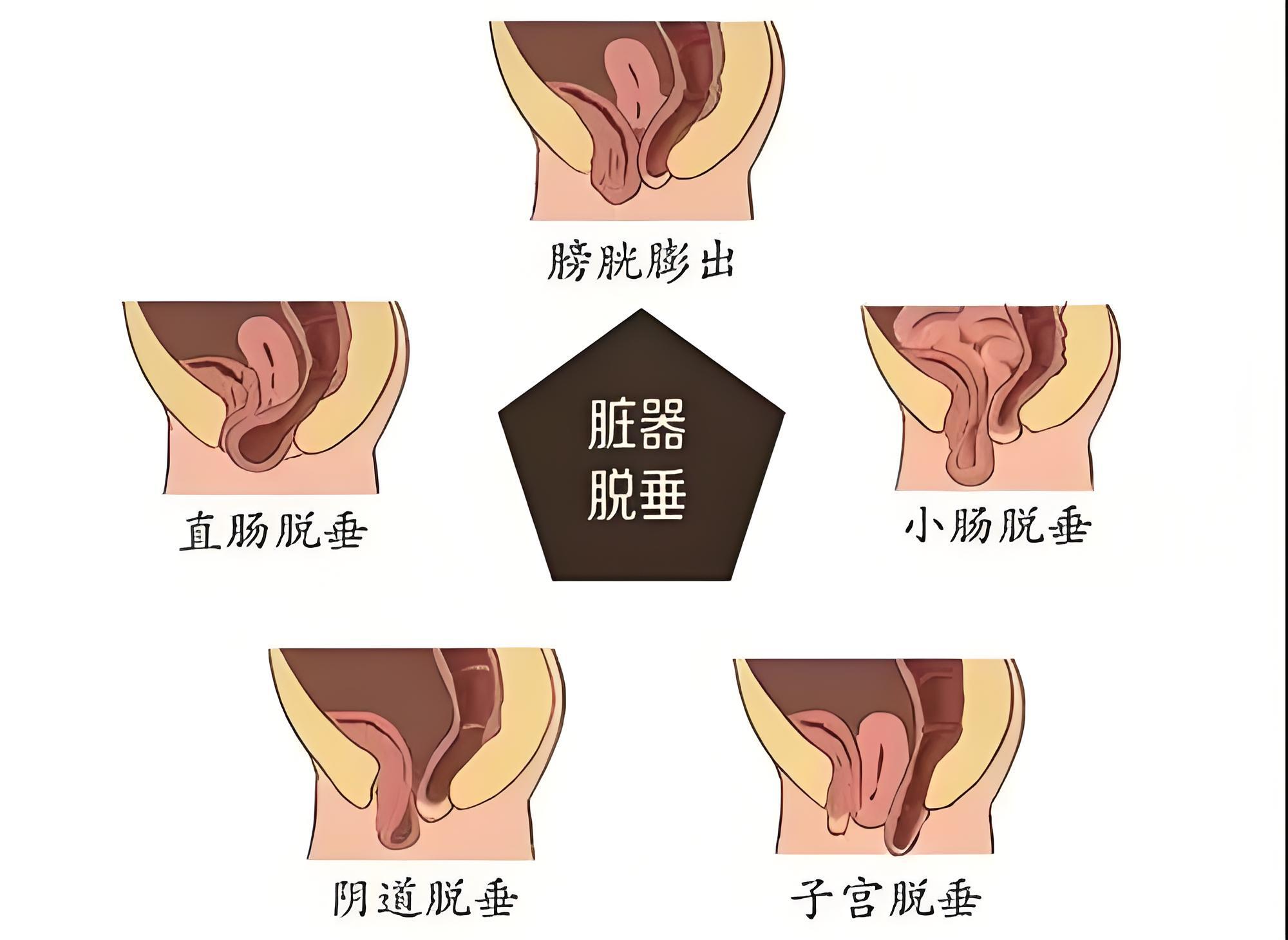 生理缩复环的位置图片图片