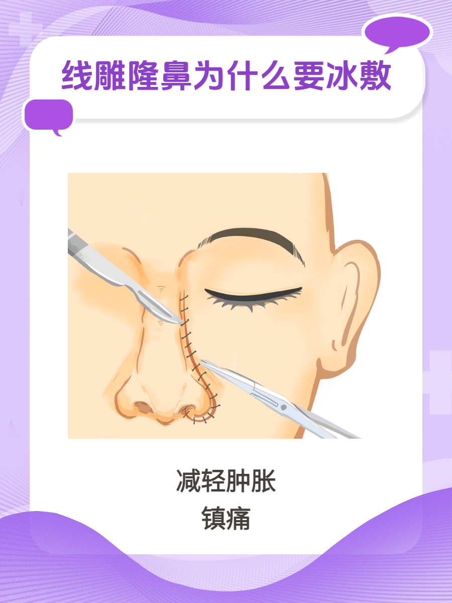 线雕隆鼻,这种非手术的鼻部整形方法,通过植入可吸收的