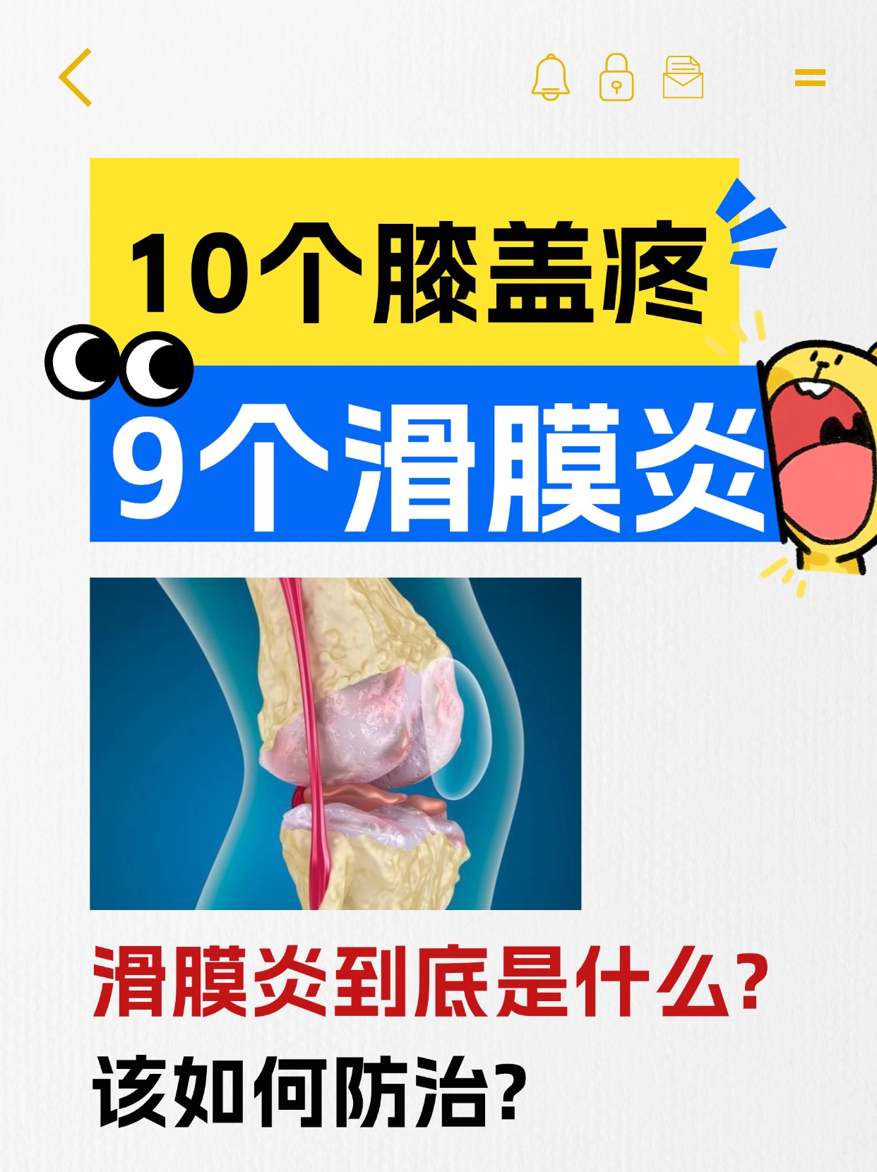 膝盖疼挂号挂哪个科(膝盖疼挂号挂哪个科做什么检查)