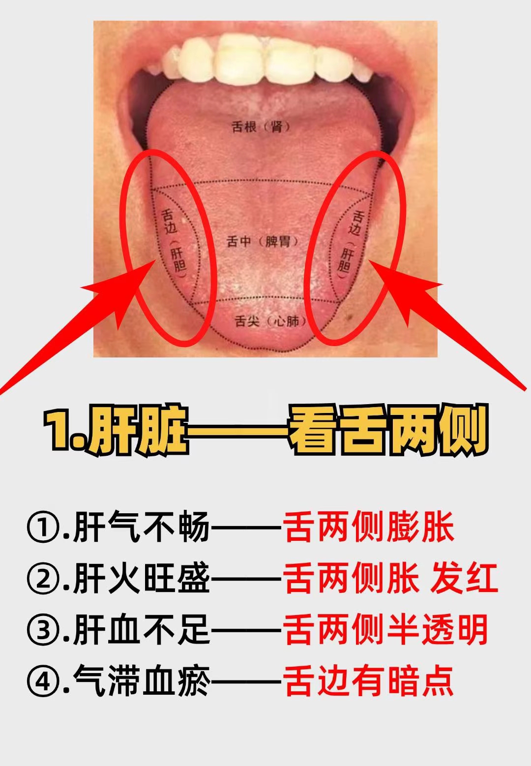 舌苔对应五脏图片图片