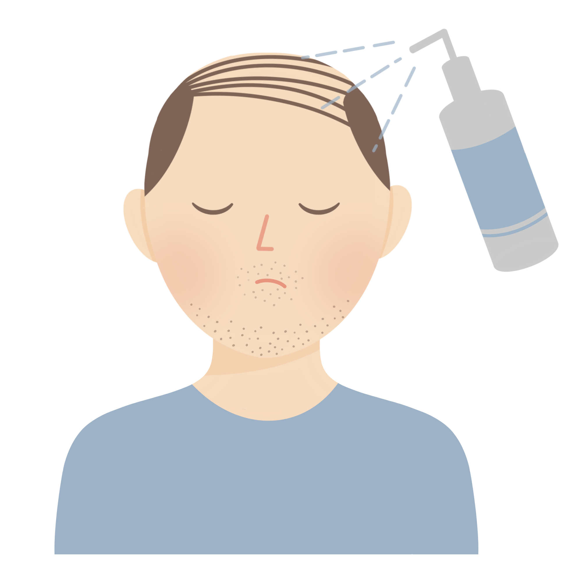 随着年龄的增长,许多人会遇到秃头的问题,尤其是男性