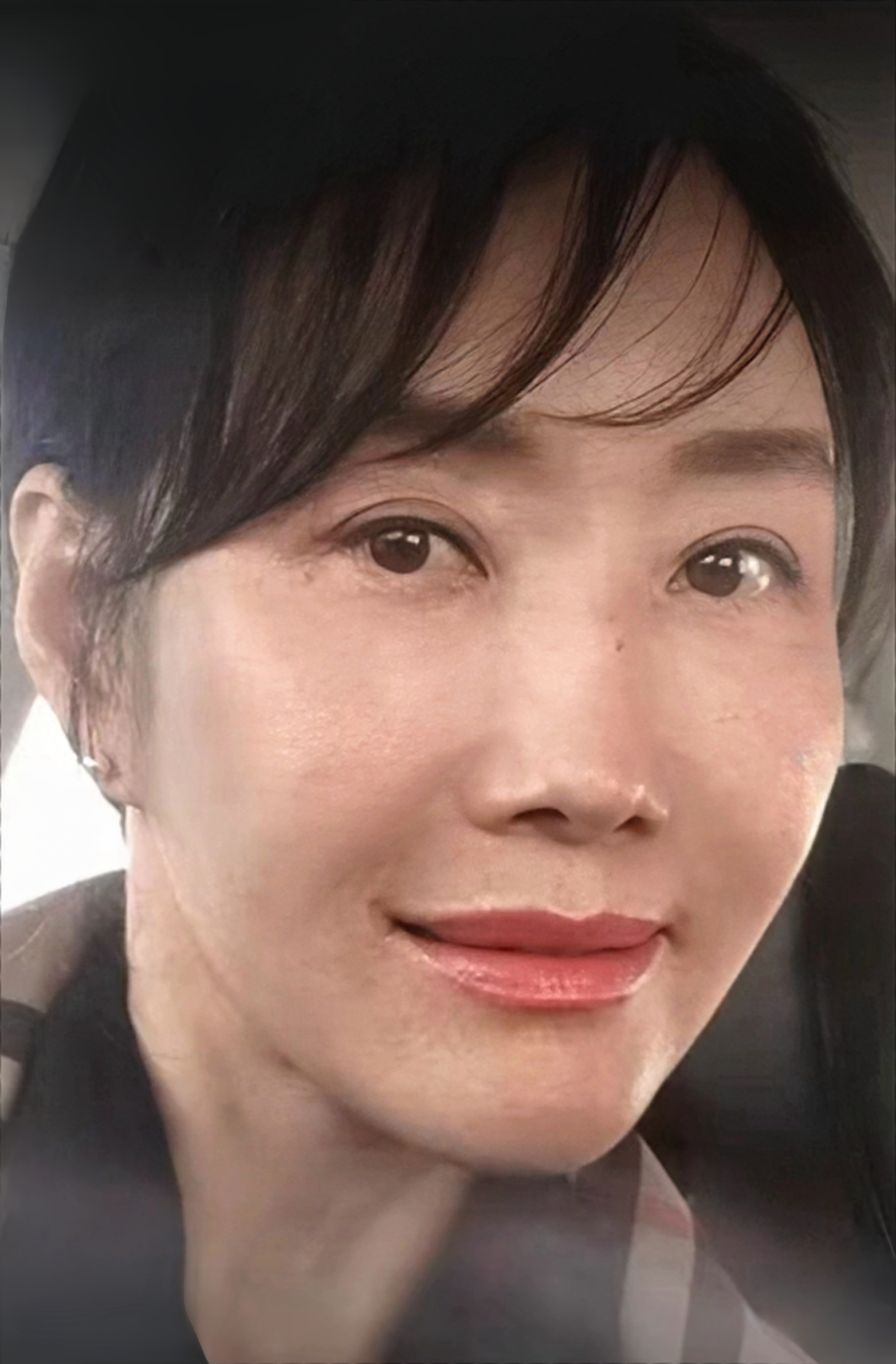 做出去做拉皮的决定,我也承认是有些冲动了!