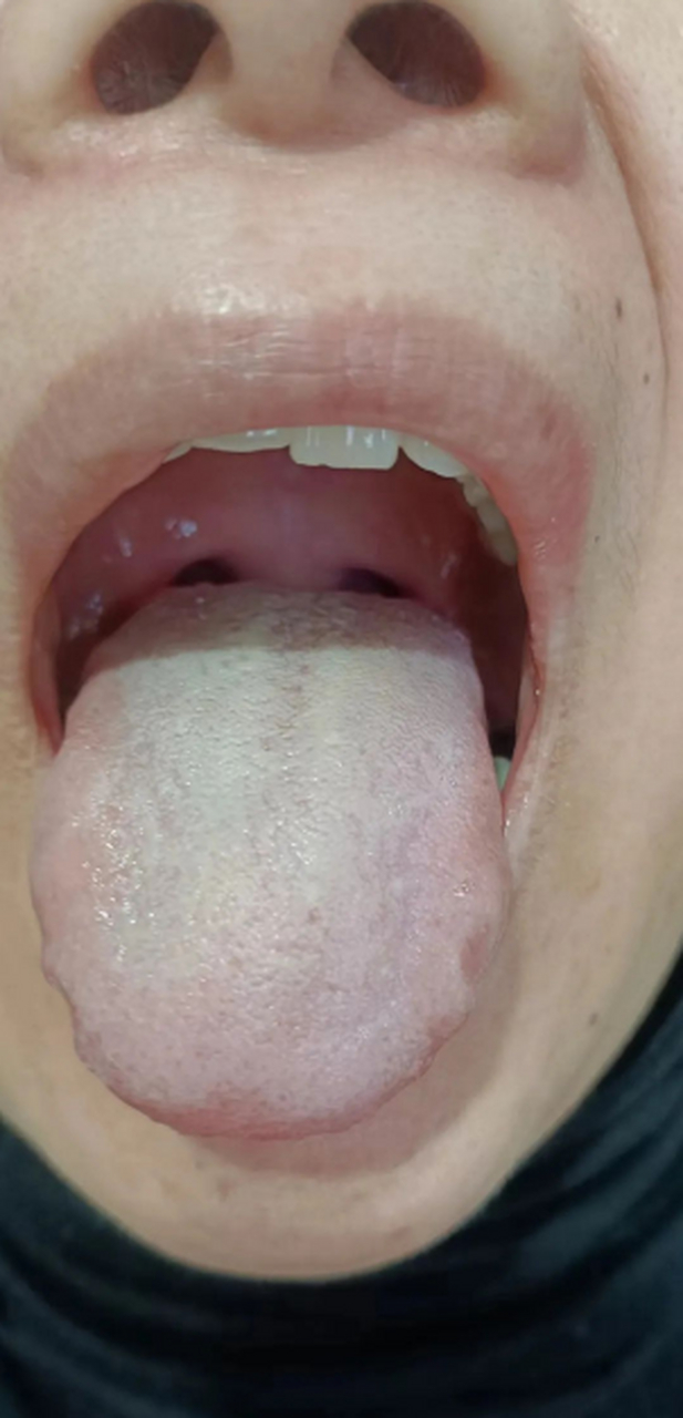 来看今日粉丝舌诊案例分析:[祈福][祈福][祈福]