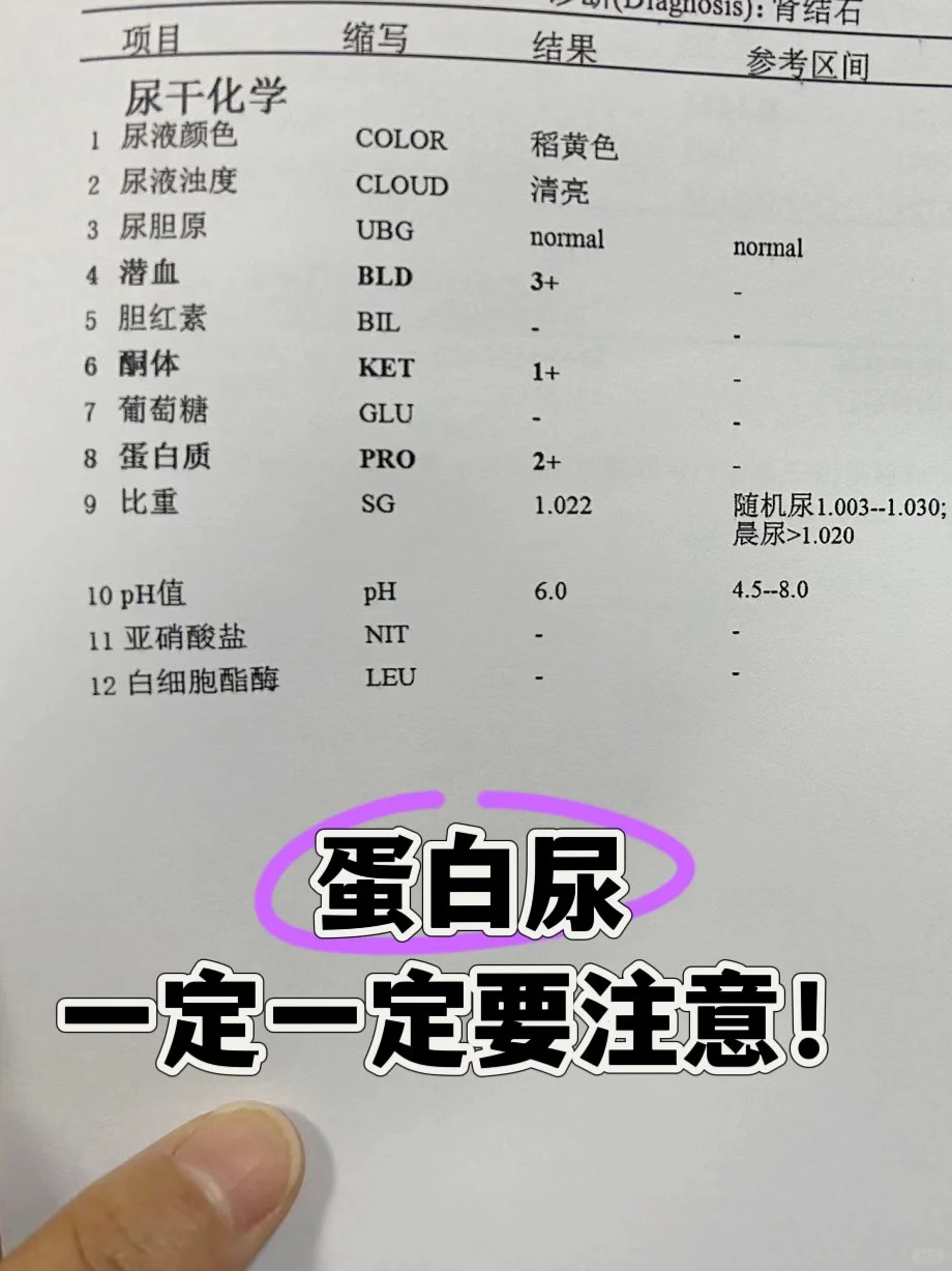 作为肾脏疾病常见的症状,不少人在提及尿蛋白的时候
