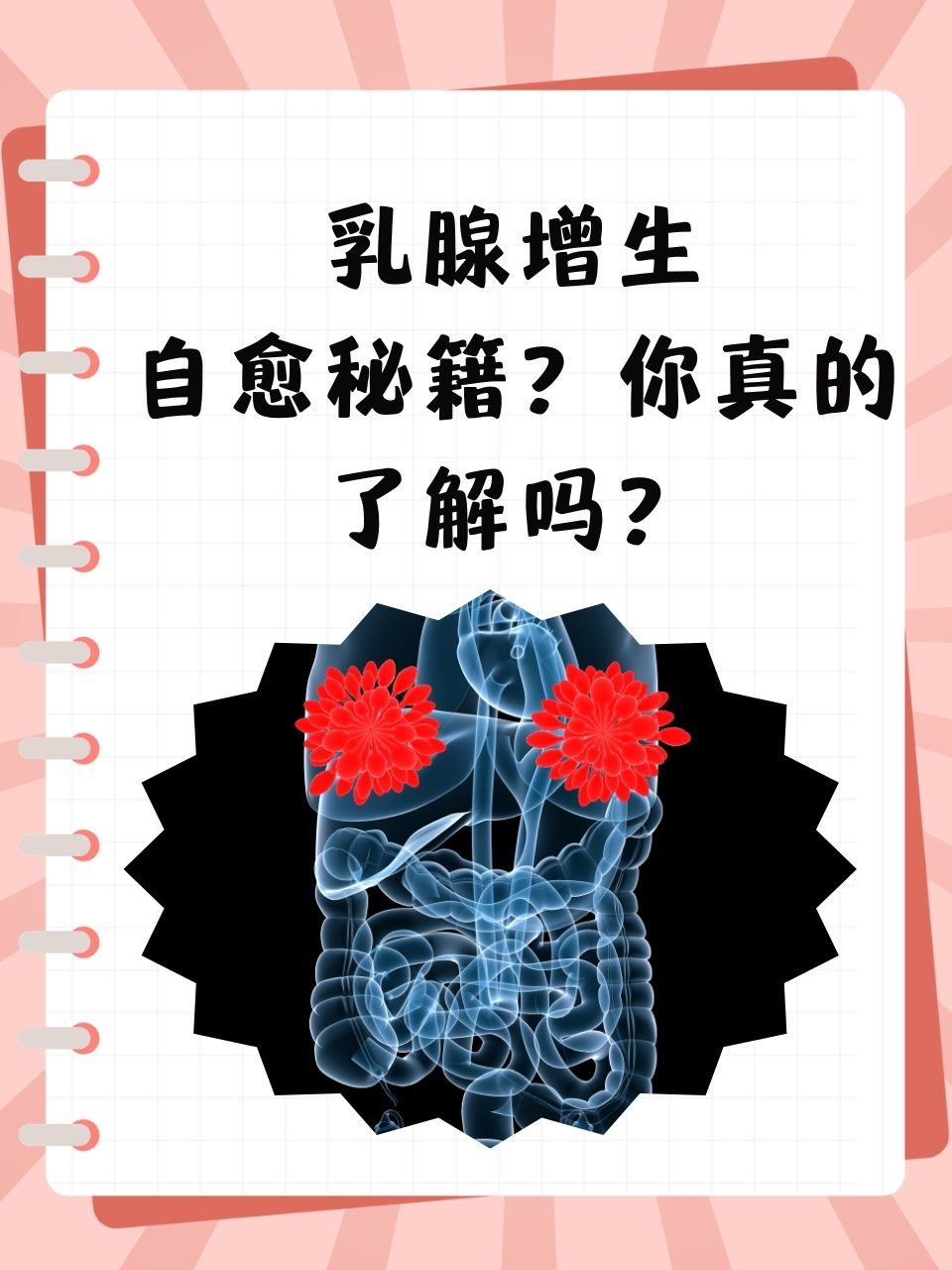 乳腺增生症现象图片