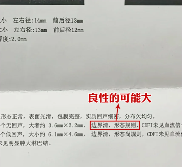 一秒钟,教你甲状腺超声报告 4组专业词汇,让你知道结节的轻重程度,良