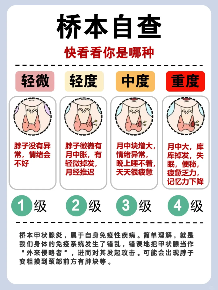 桥本氏病最明显的三种表现