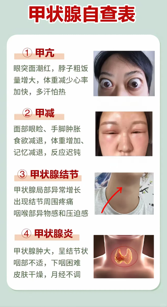 摸到硬块或黄豆大小结节 甲状腺肿大甲状腺的