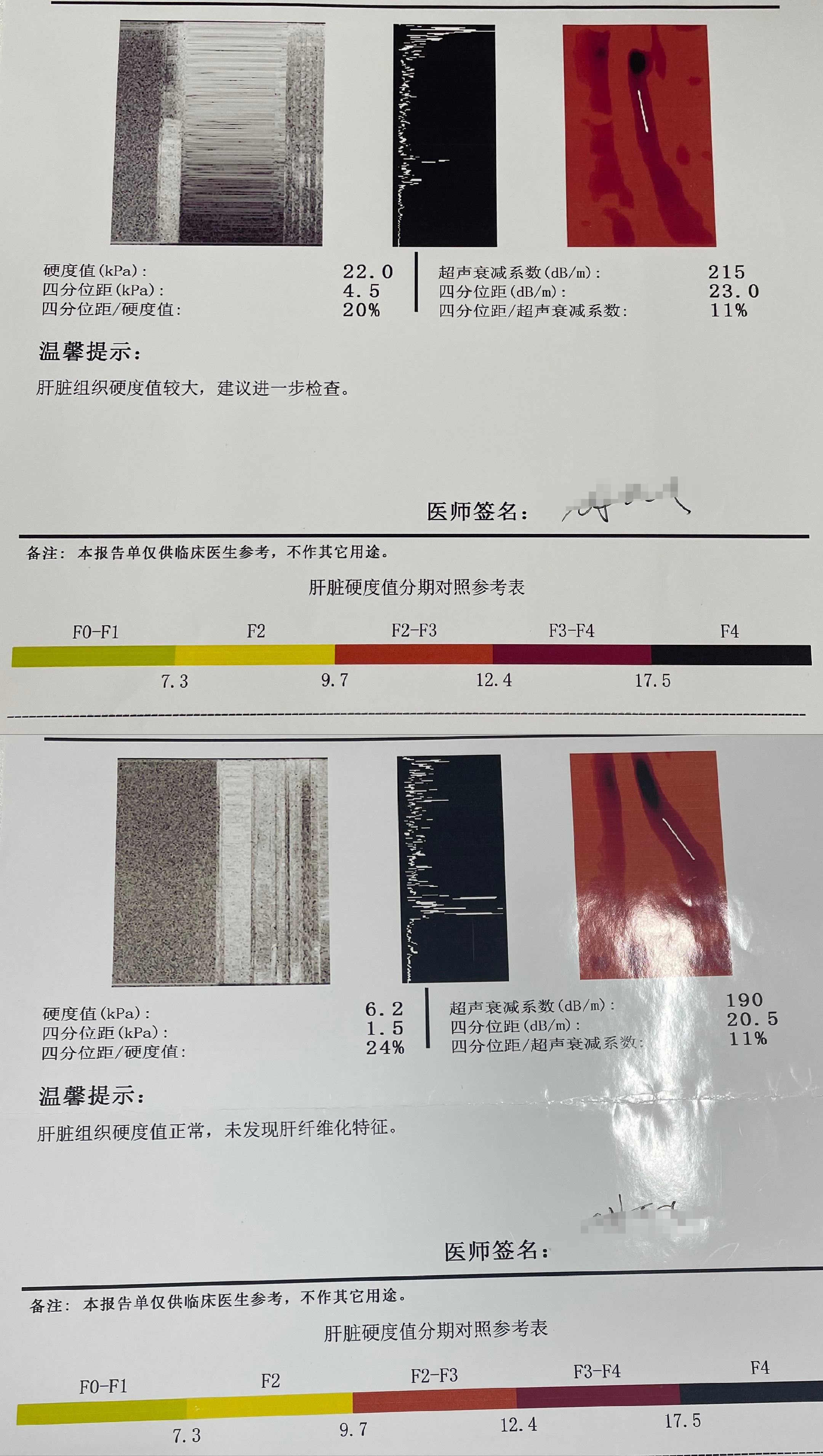 肝炎指标化验单怎么看图片