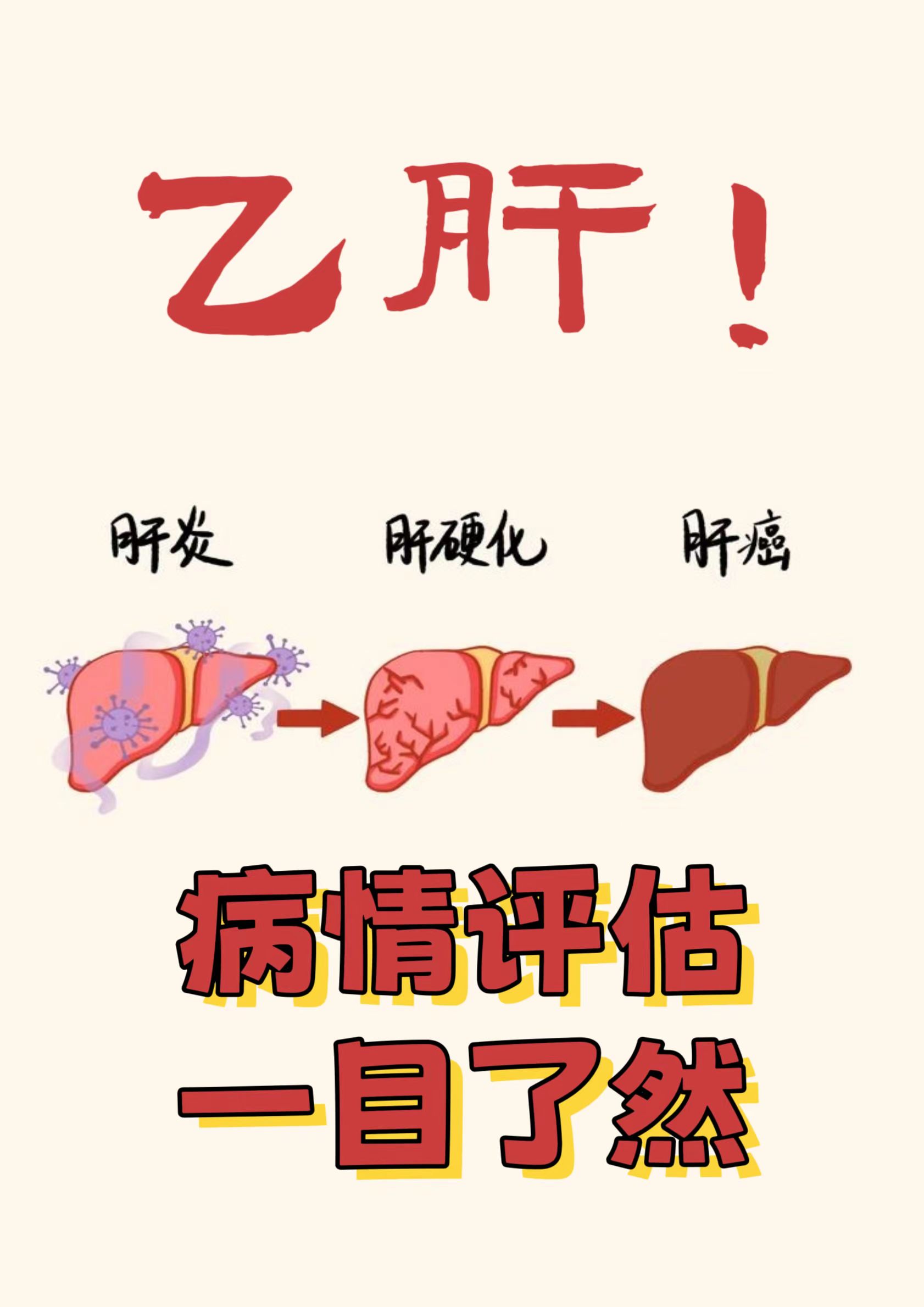 携带者:这是乙肝感染中较为轻微的情况,患者没有明显的肝病症状和体征