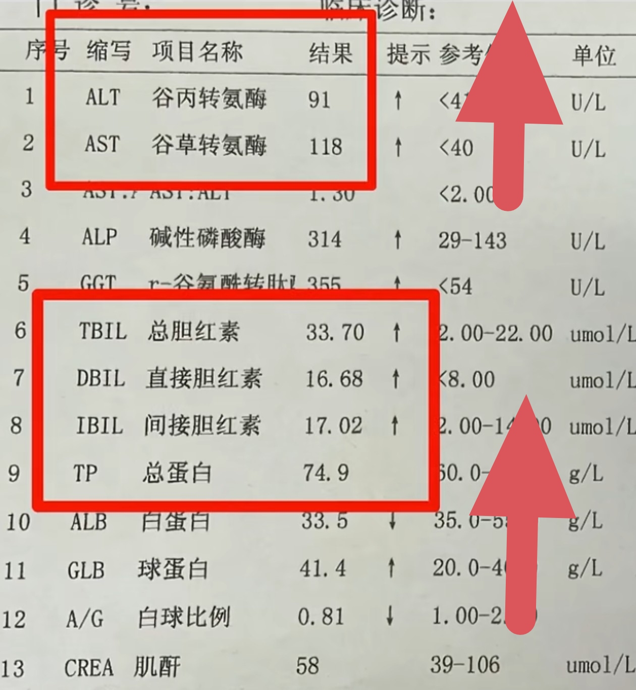 肝炎指标化验单图片