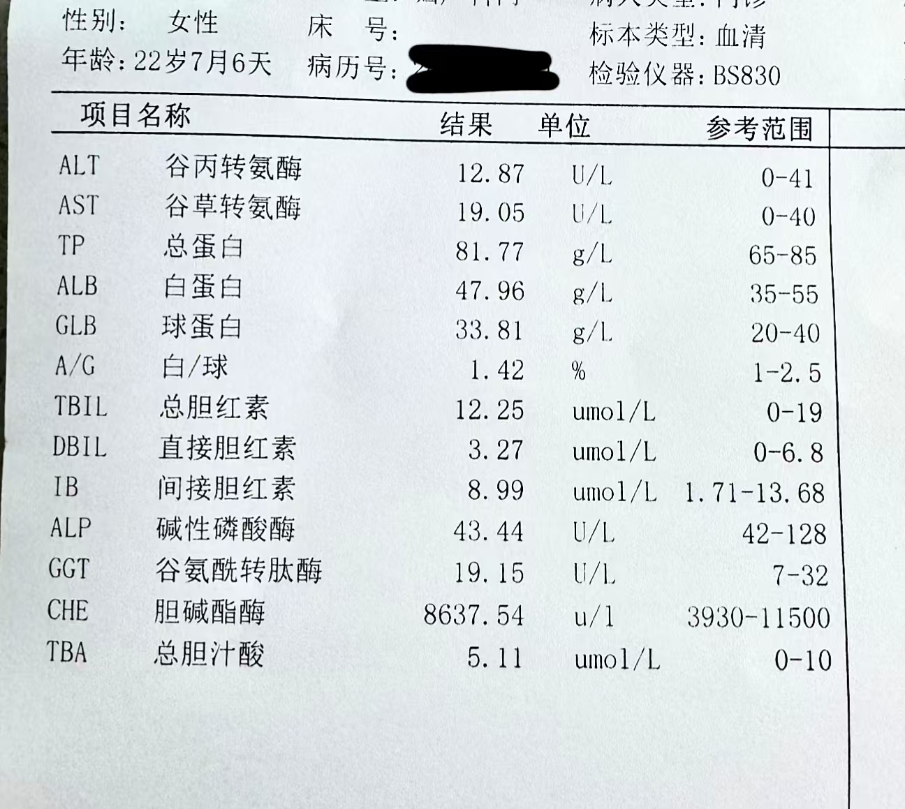 像老张的这位乙肝患者,一开始转氨酶200多,白蛋白轻微异常,碱性磷酸