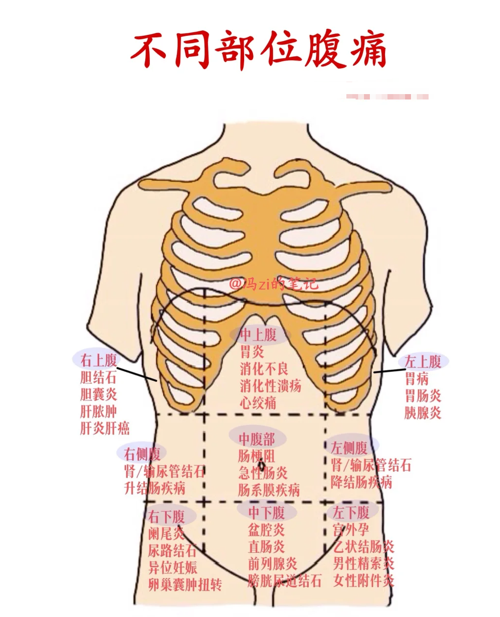 不同部位腹痛/腹部分区 收藏好这份腹部地图 仅供参考,如身体不适请