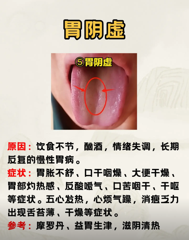 为什么会肾阴虚呢为什么在线