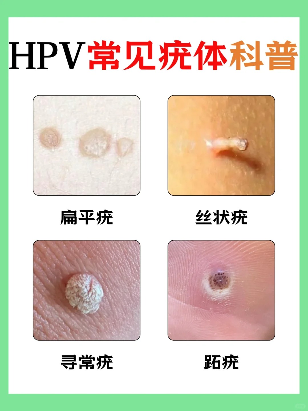 湖南长沙病毒性病特诊中心让健康相伴