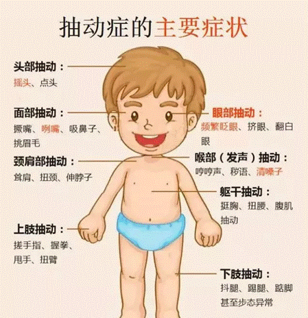 小儿痉挛症的表现图片图片