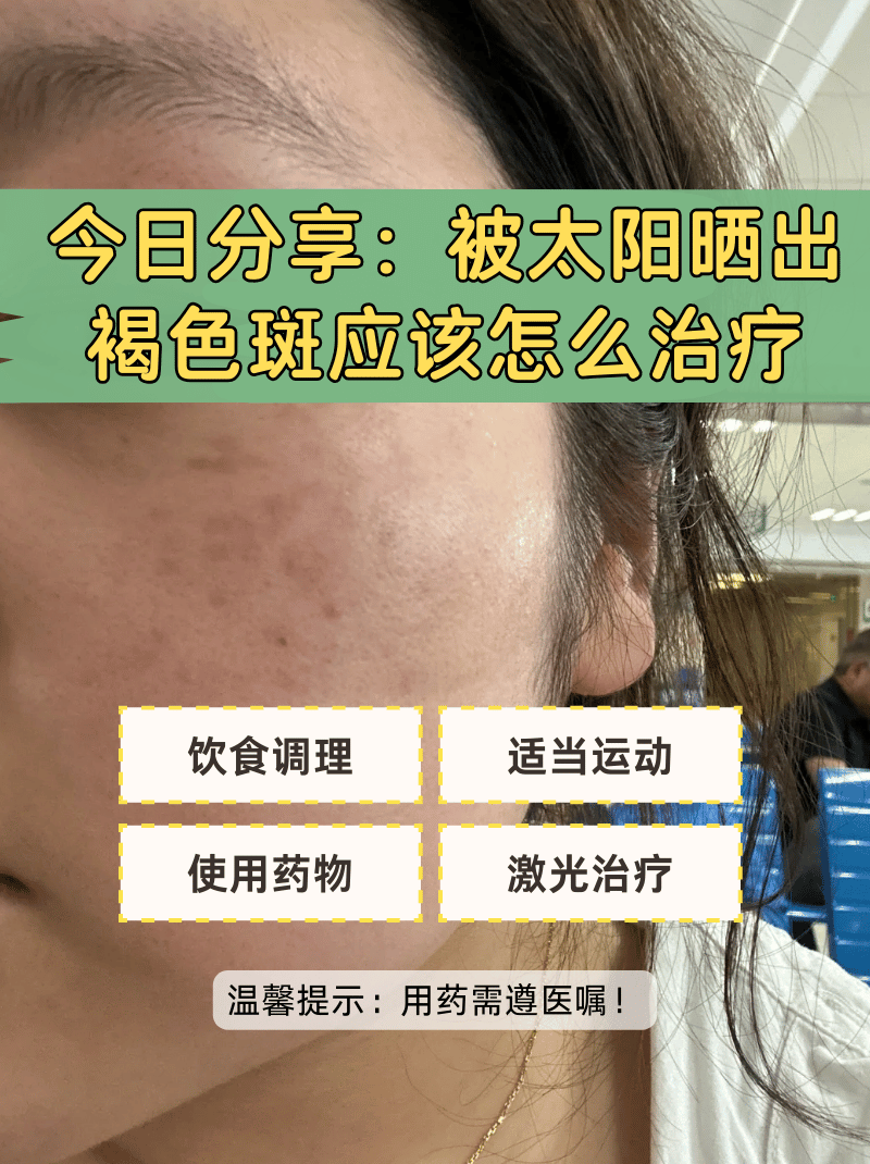 今日分享:被太阳晒出褐色斑应该怎么治疗