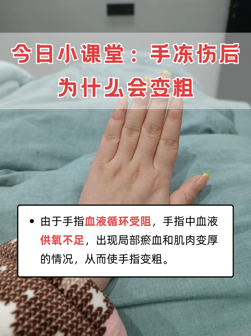 为什么手冰凉但是腋窝出汗百科在线