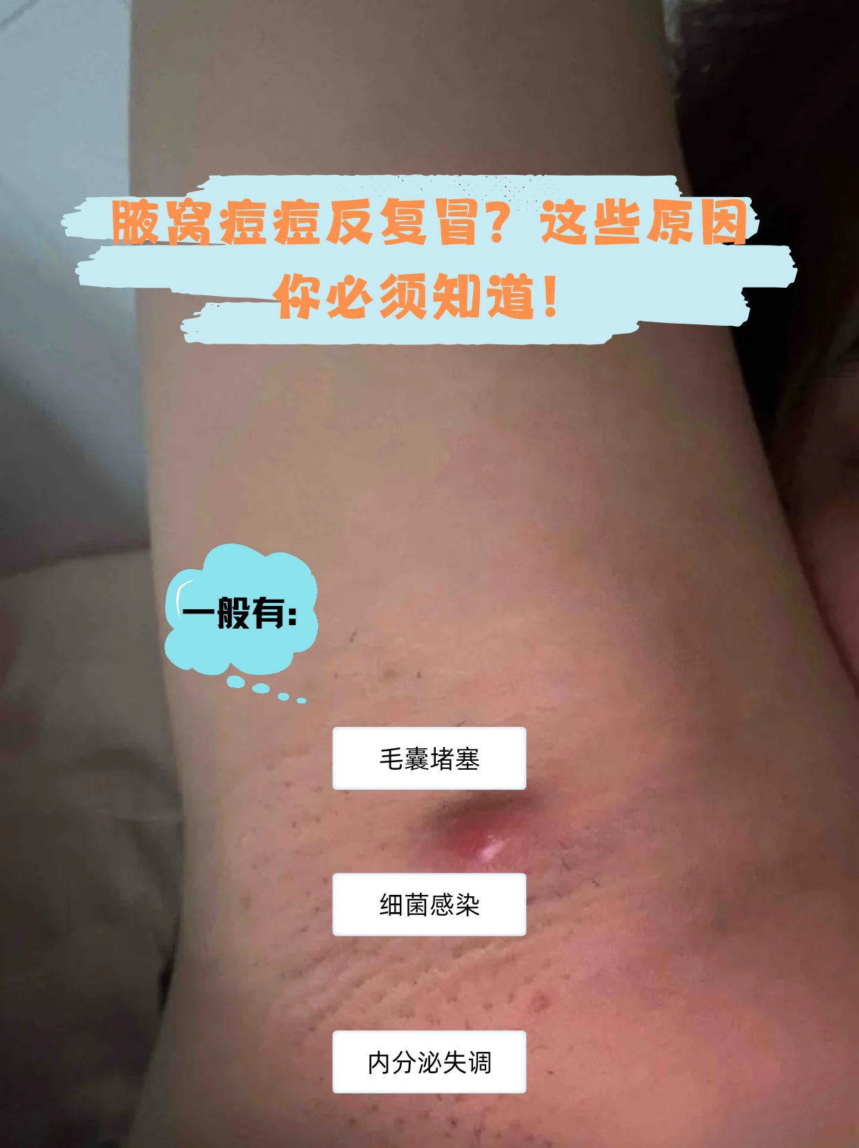 这些原因你必须知道!