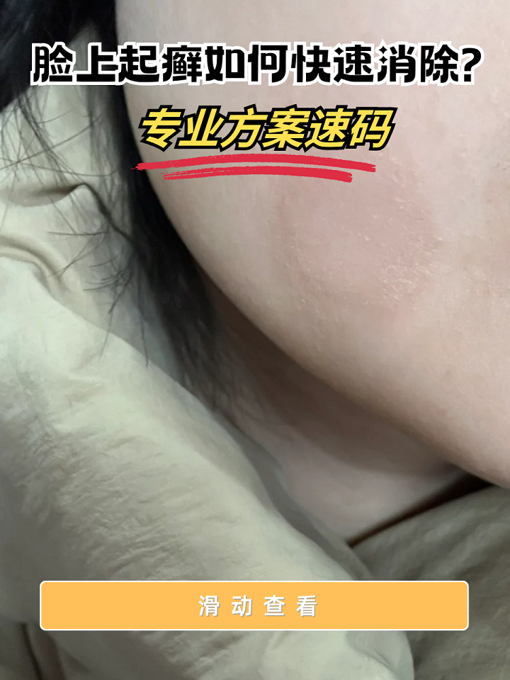 为什么脸上会真菌感染