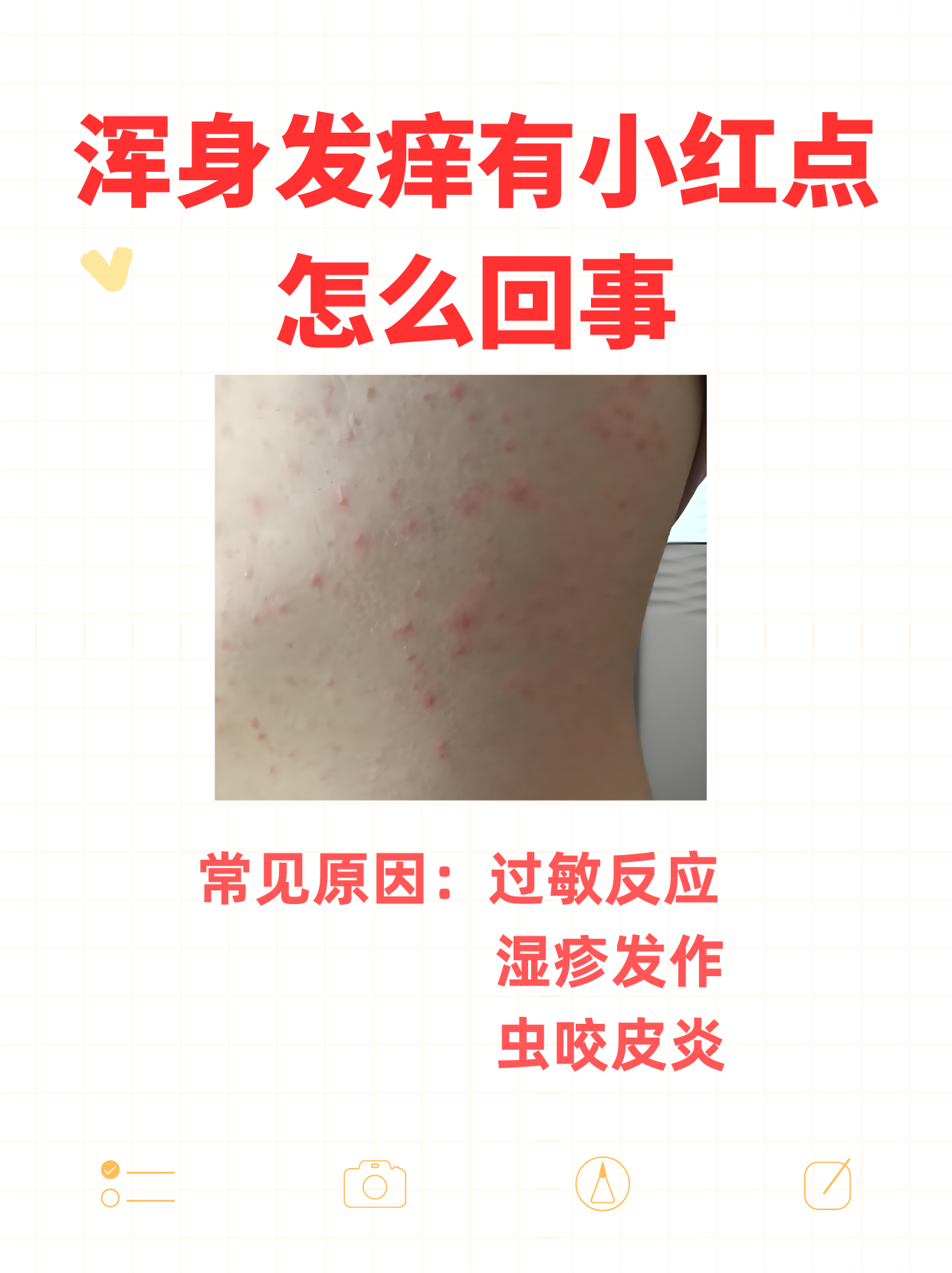 为什么浑身发痒