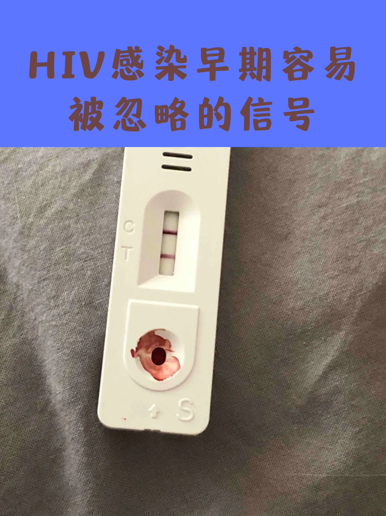 hiv感染早期容易被忽略的信号