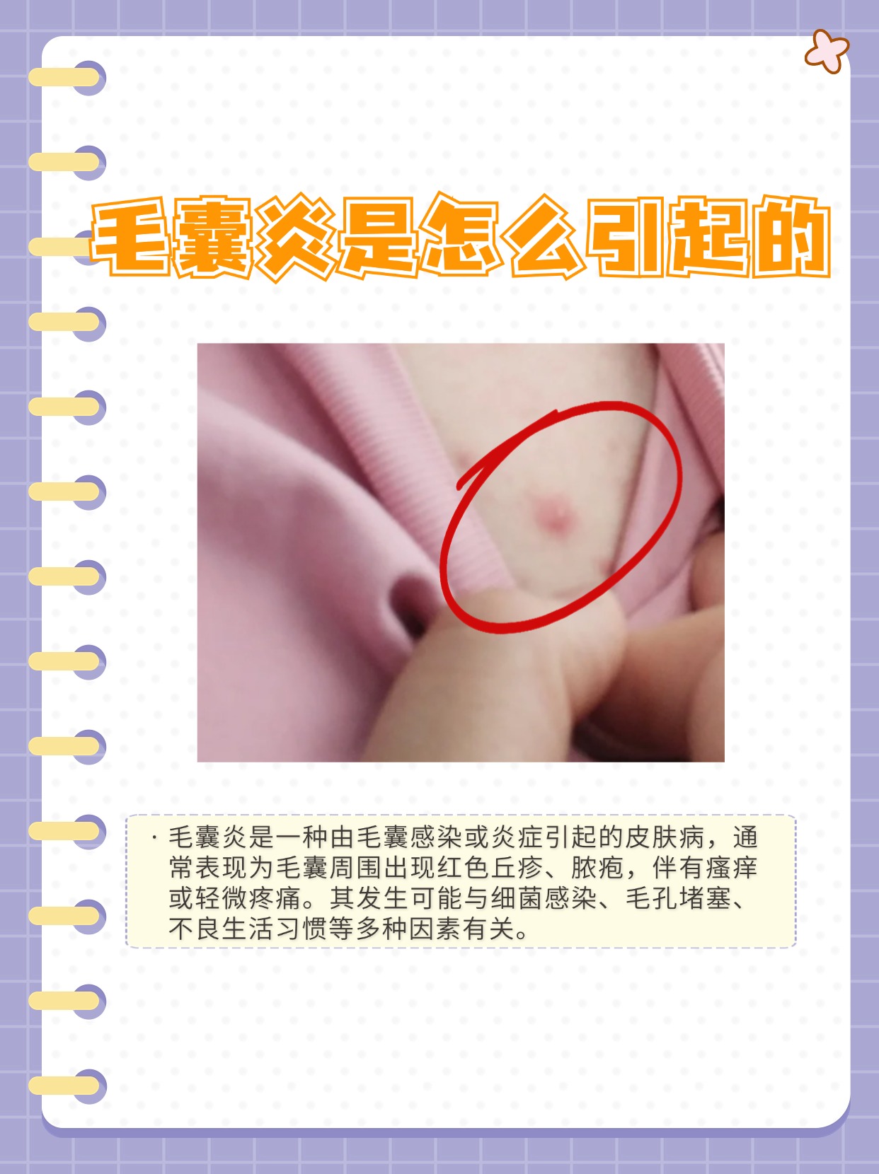 为什么有炎症 为什么有炎症