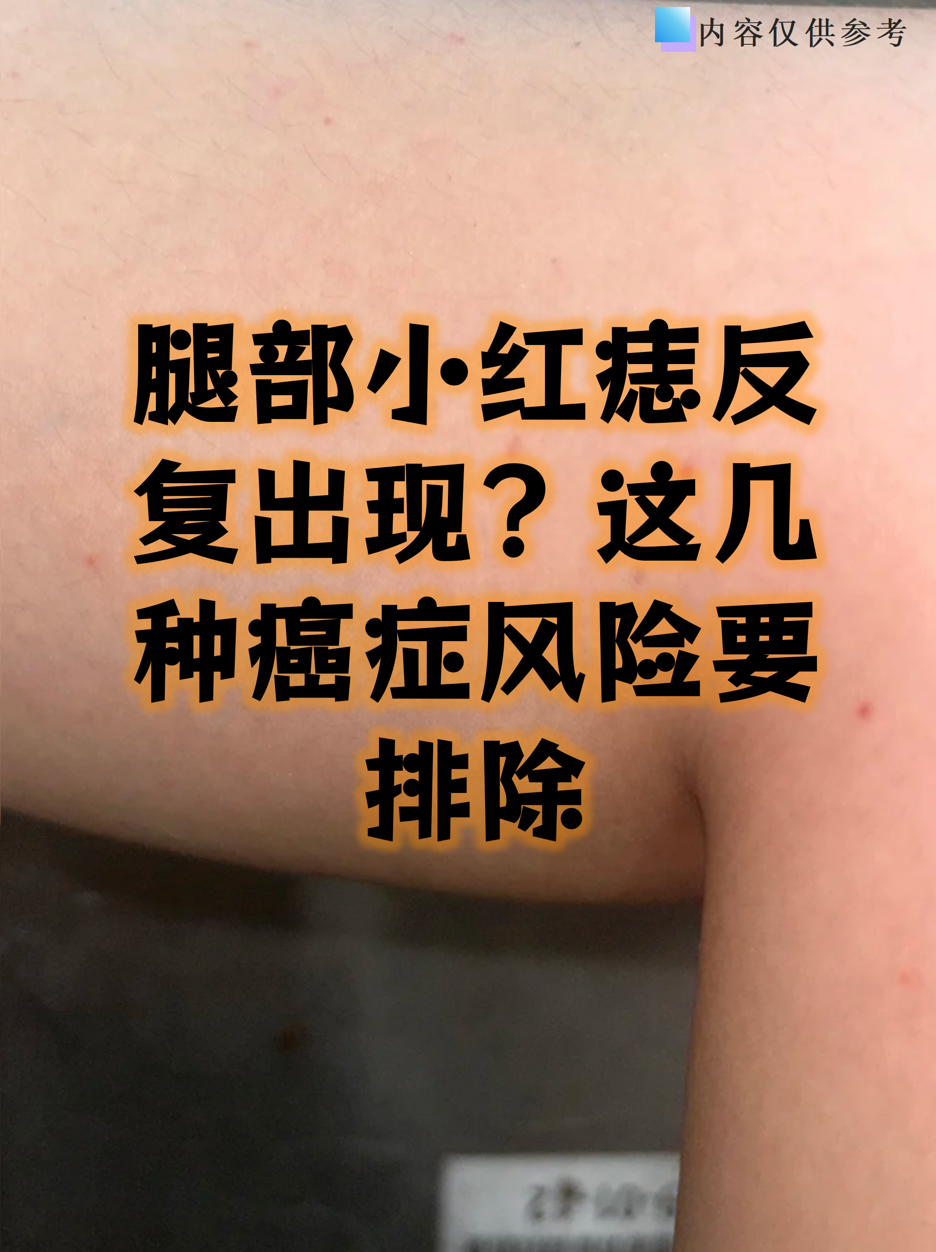 腿部小红痣反复出现?