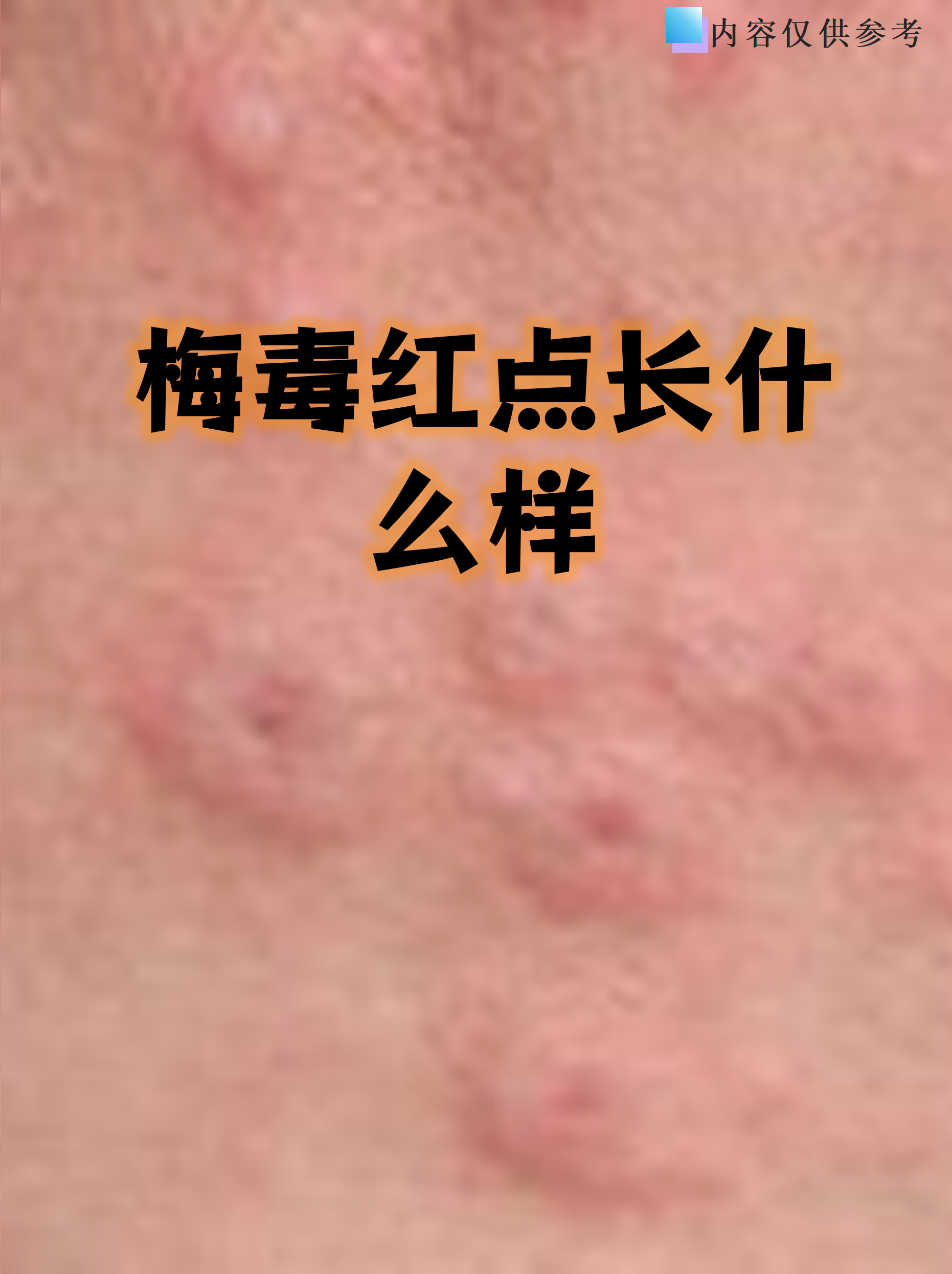 梅毒红点典型特征 硬下疳期红点:初期为无痛性圆形溃疡