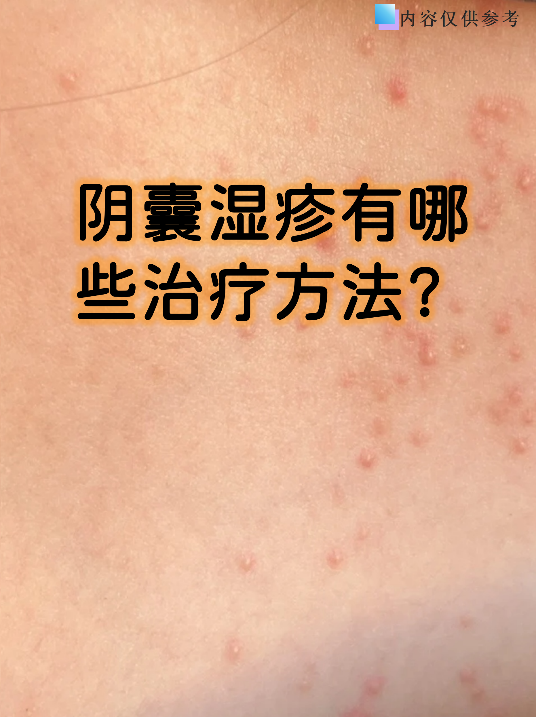 阴囊湿疹让人坐立不安,瘙痒红肿还容易反复发作