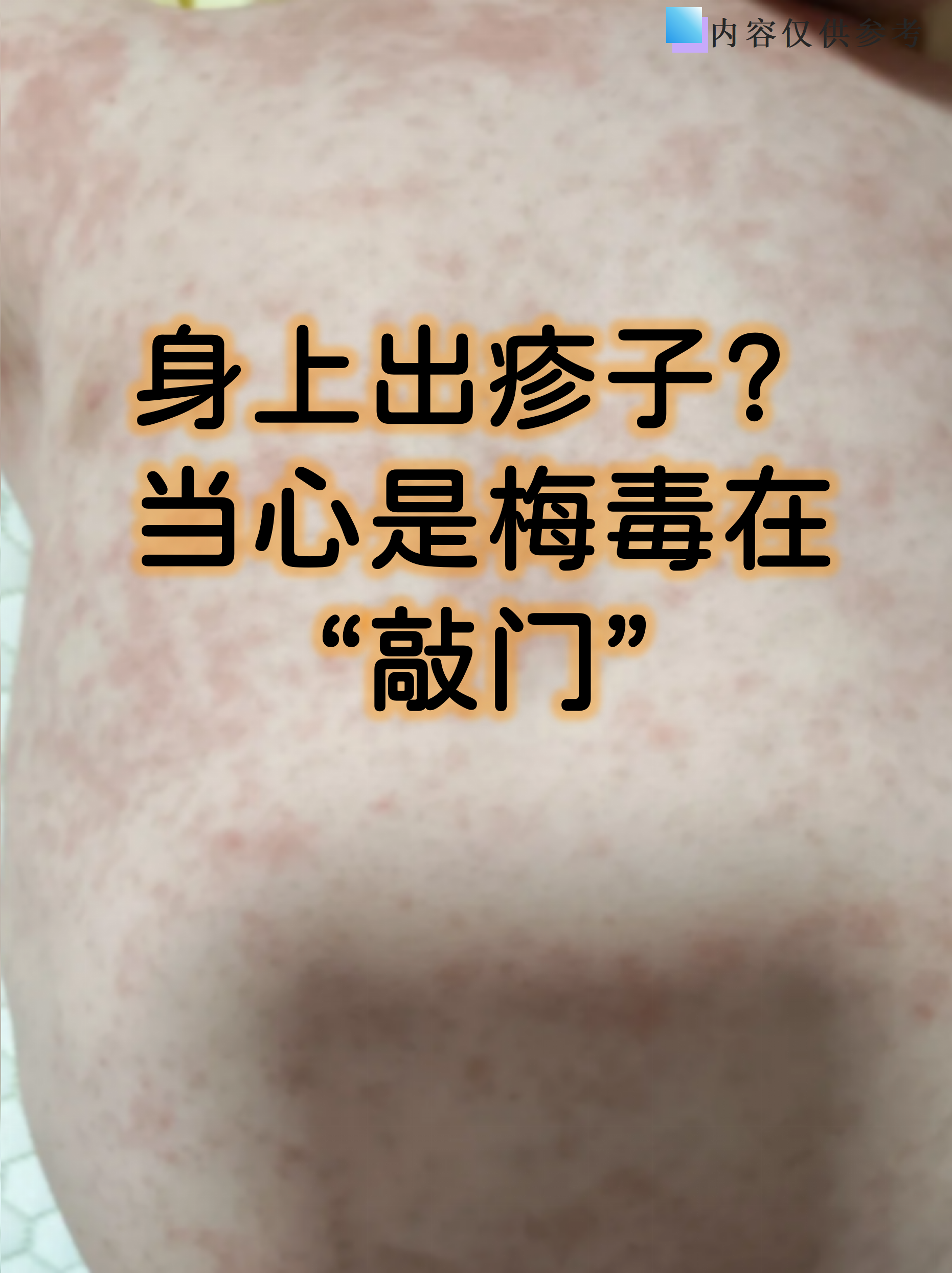  广东发现什么传染病了呢(广东流行的传染病)