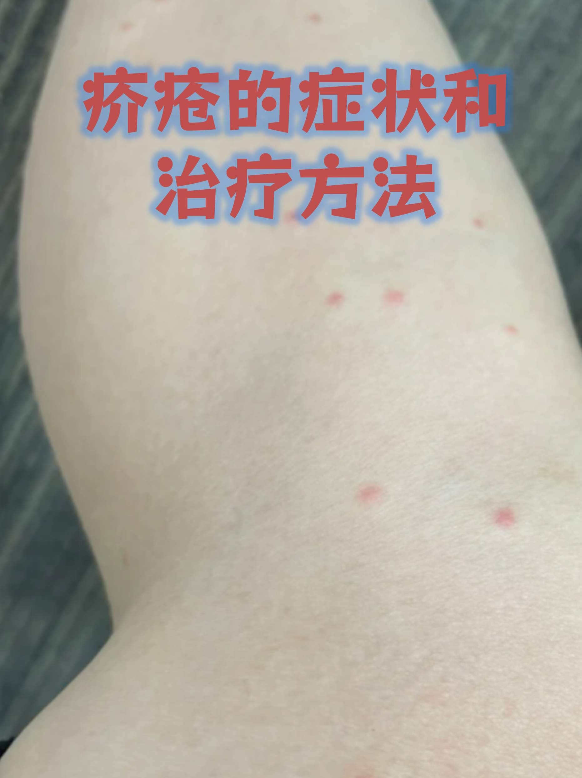  最近的传染病症状(近期传染病有哪些症状)