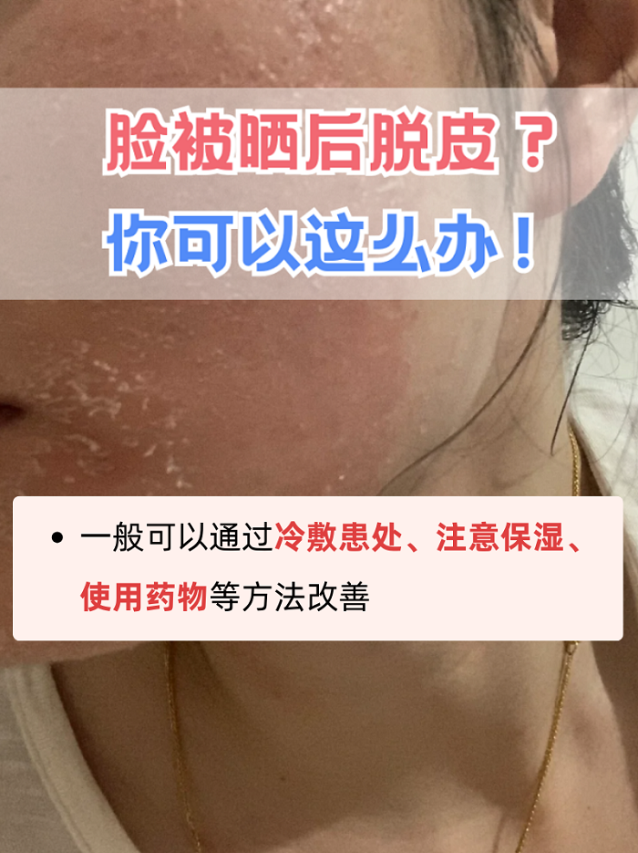 为什么脸会脱皮还百科在线