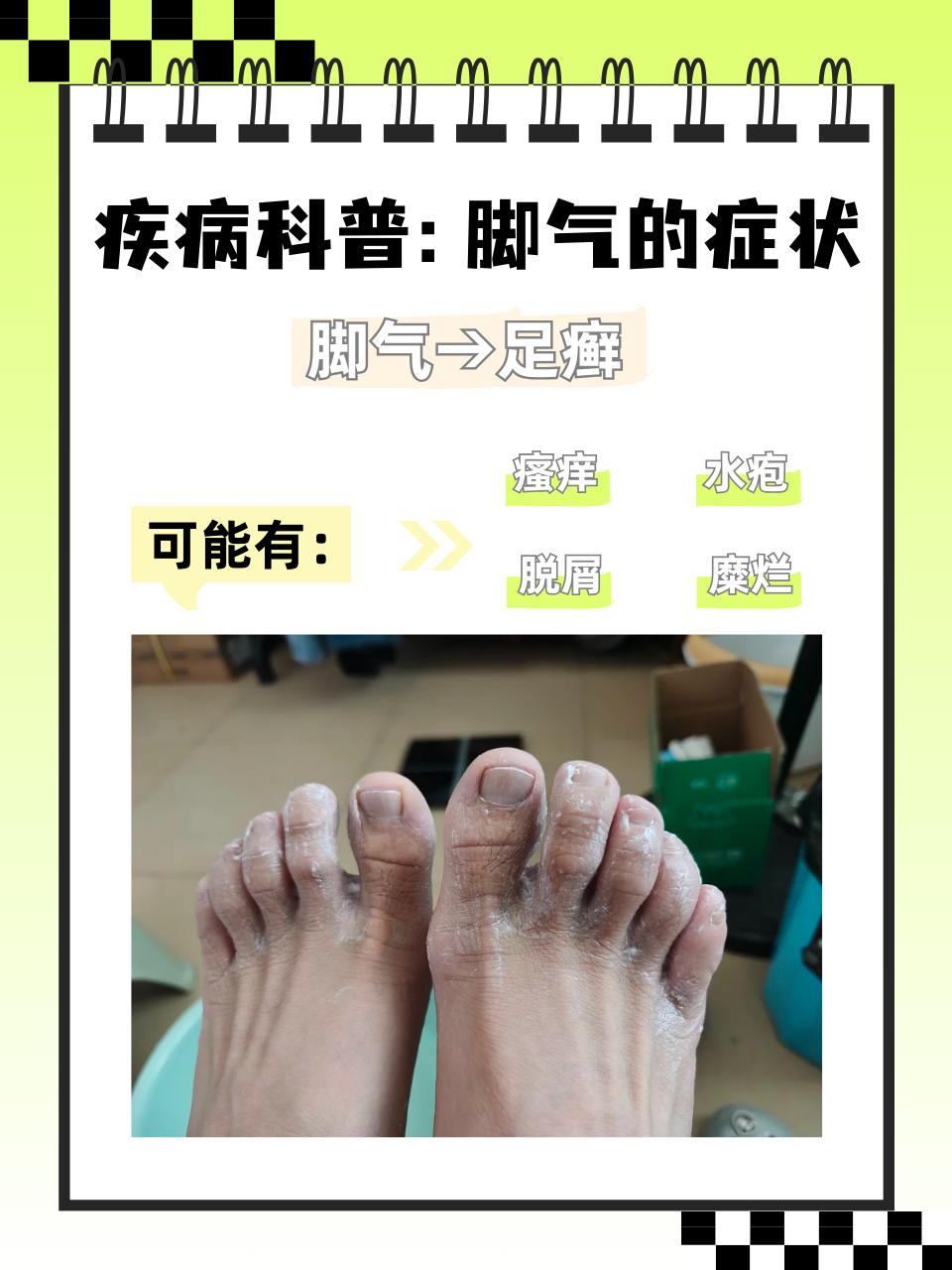 脚为什么会痒越抓越痒