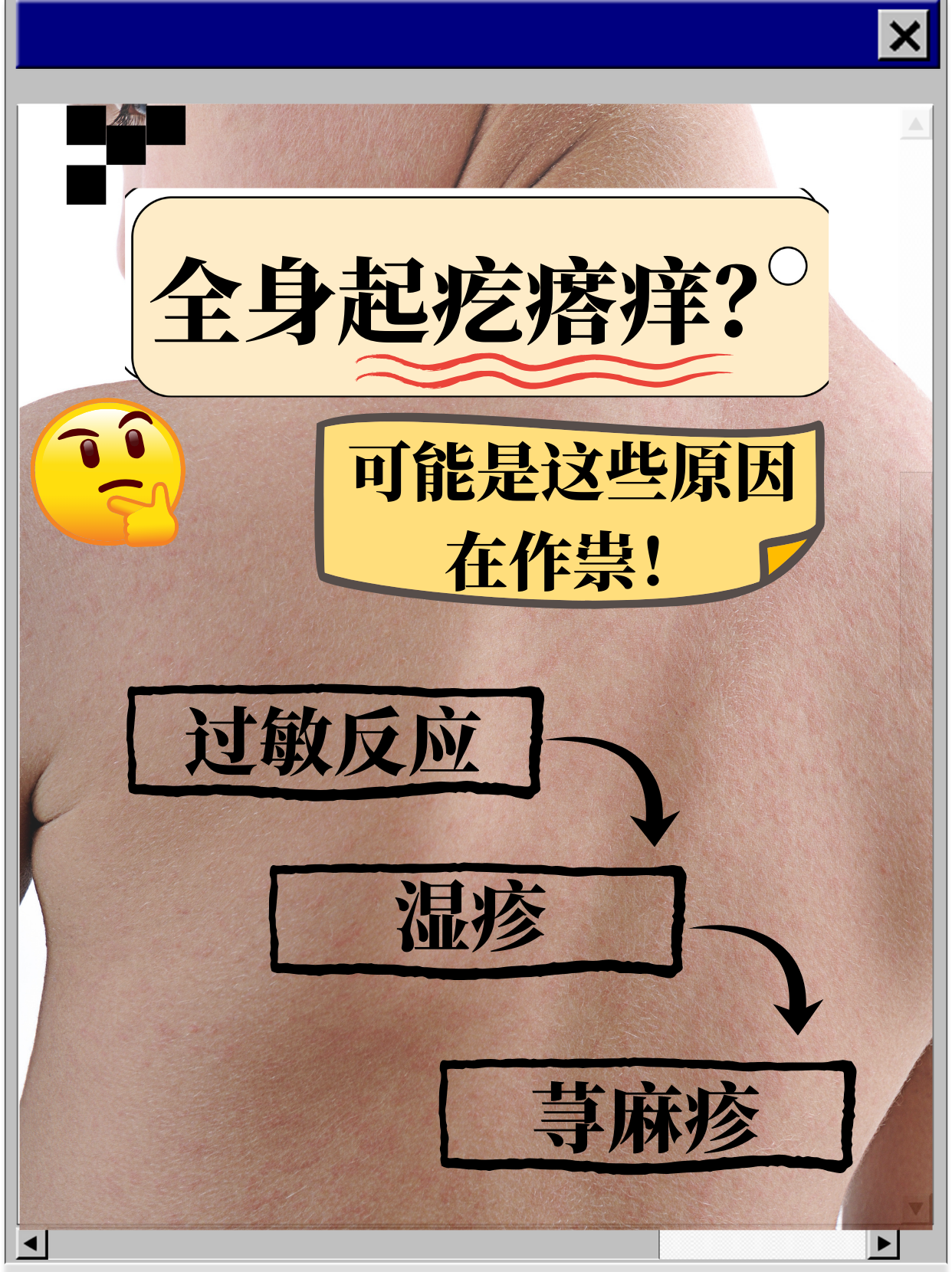 为什么会身上痒一抓就起疙瘩百科在线 为什么会身上痒一抓就起疙瘩百科在线
