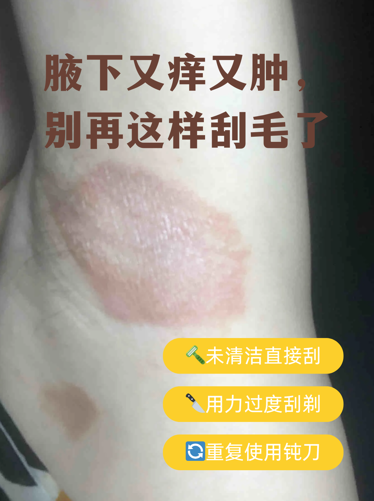 腋下又痒又肿,别再这样刮毛了