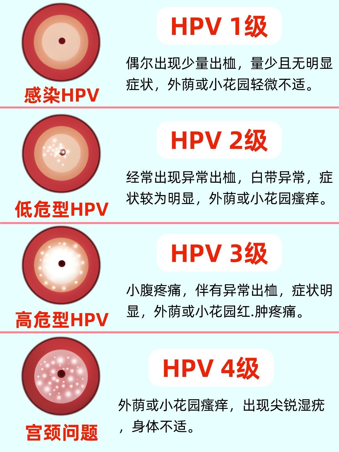 hpv阳性对照表,快来看!#hpv感染# #hpv