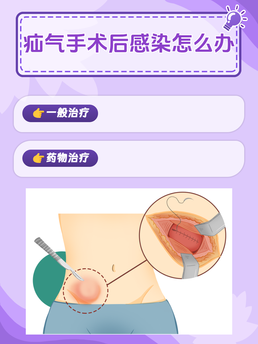 这些治疗方法必须知道  疝气手术是治疗疝气的有效方法,但术后感染是