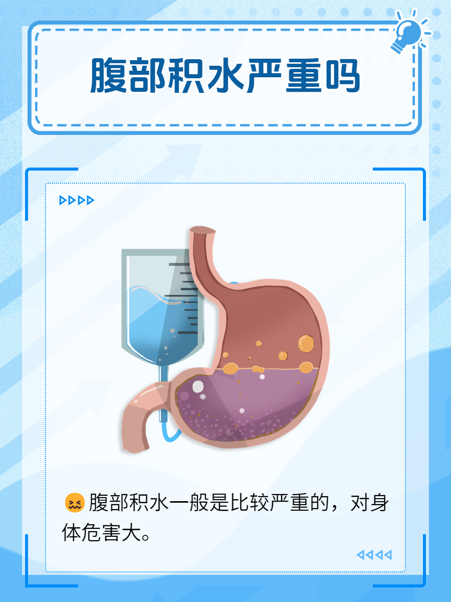 怎样判断是否腹部积水图片