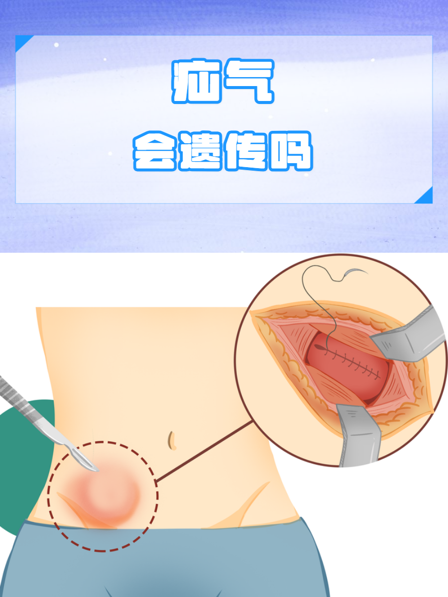 一文了解其遗传性  在我们日常生活中