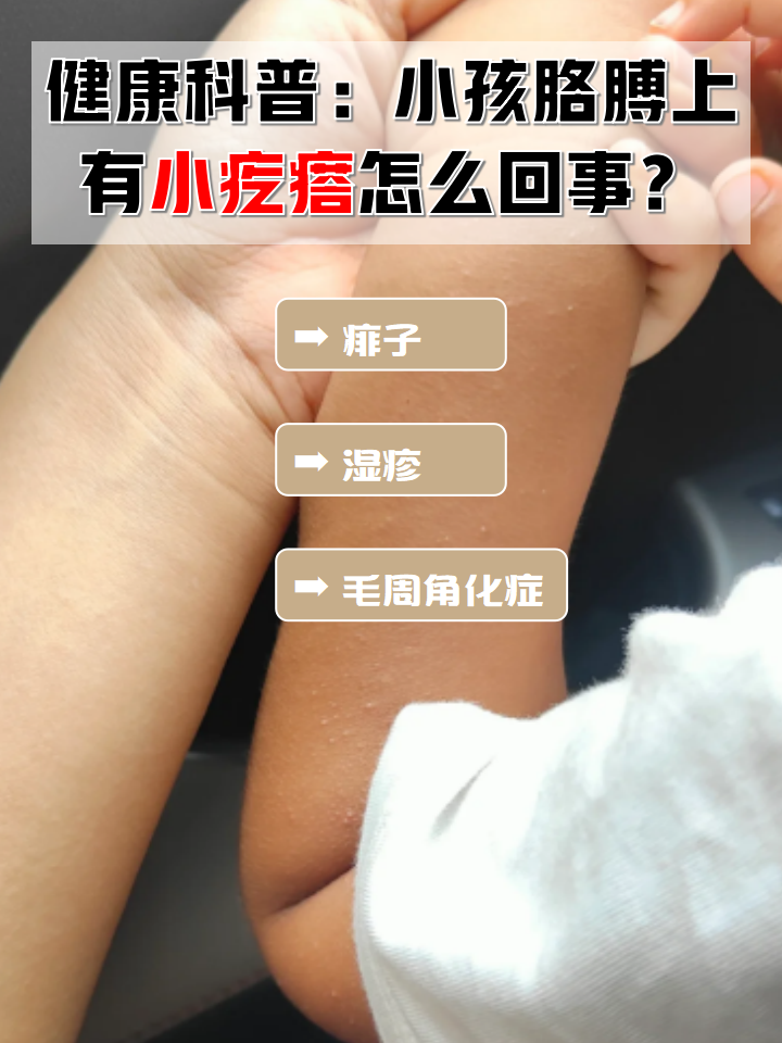 为什么会长疙瘩