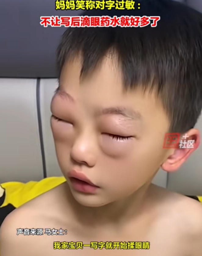 孩子撕心裂肺哭声,妈妈进屋一看,瞬间傻眼,孩子眼睛肿的比核桃还大,都