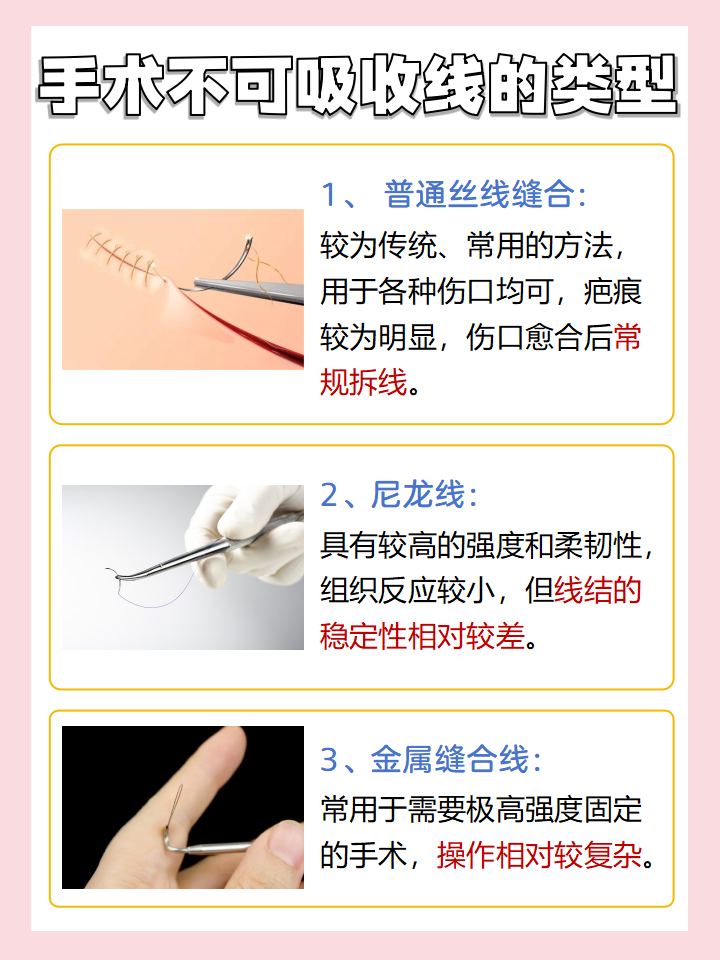 解答|手术线多长时间脱落?